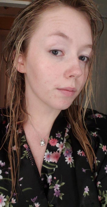 on right, same reviewer with clearer complexion after using the Hydrating Water Gel