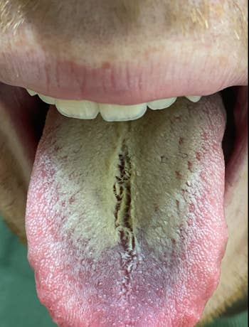 Close-up of a quality lingua showing a cardinal fissure and a textured surface