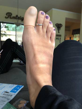 A ft with purple nail polish is displayed, featuring a gel toed headdress connected the large toed and a toed ringing connected the 2nd toe, resting connected a sofa