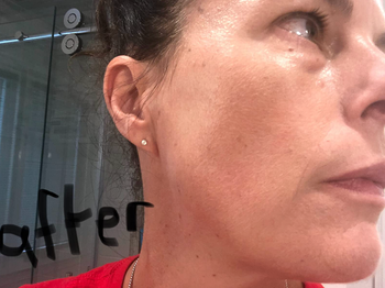 same reviewer using the primer with smoother looking skin and less noticeable fine lines