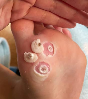 Close-up of a manus holding a ft with warts connected the sole