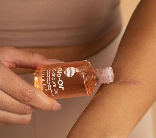 A model rubbing bio-oil on their arm 