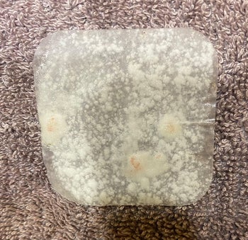 The XL pimple patch afterwards, with tons of white gunk from their skin