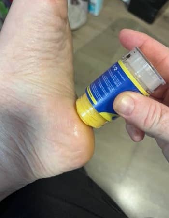 Heel balm being applied to a person's adust  foot, apt  utilized  for moisturizing and repairing cracked heels