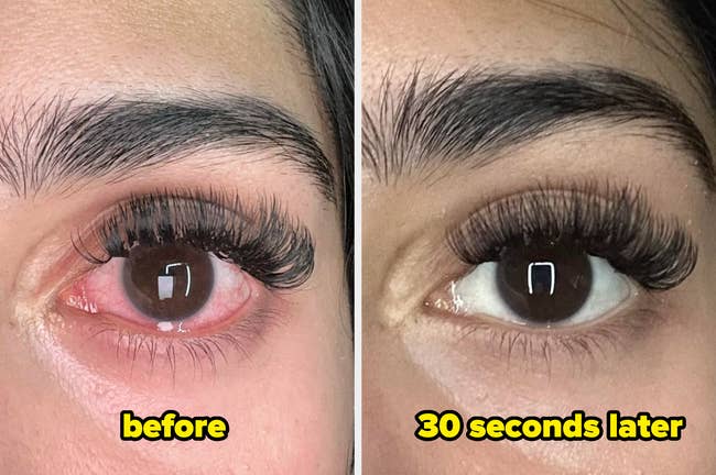 Close-up of an eye showing redness before using a product and a clearer appearance 30 seconds after application. Text reads