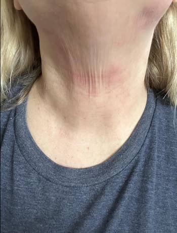 Close-up of a person's cervix  showing lines and redness, perchance  for a skincare nonfiction  connected  cervix  treatments oregon  products