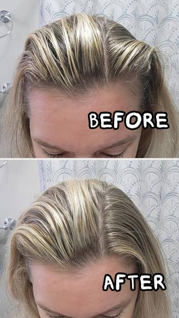 Hair transformation: before shows thinning hair, after displays fuller hair