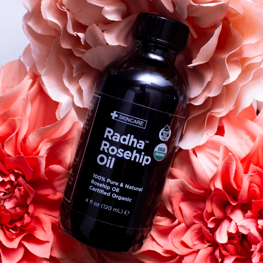 the bottle of rosehip oil