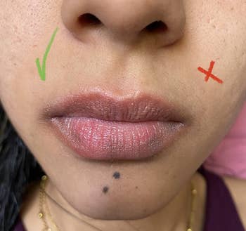 Close-up of a reviewer's lips with a peach fuzz on the left cheek and no peach fuzz on the right cheek