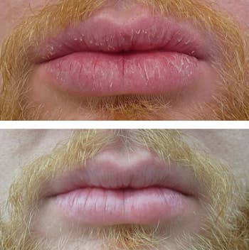A reviewer's before/after showing healed cracks in their lips