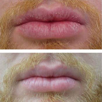 A reviewer's before/after showing healed cracks in their lips