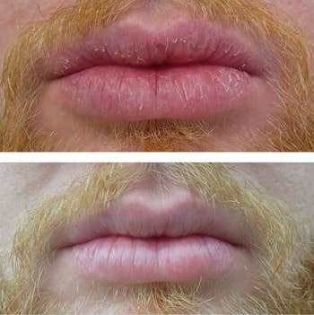 A reviewer's before/after showing healed cracks in their lips
