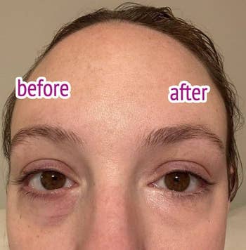 24 Products That’ll Make You Feel Like You Have A PhD In Skincare