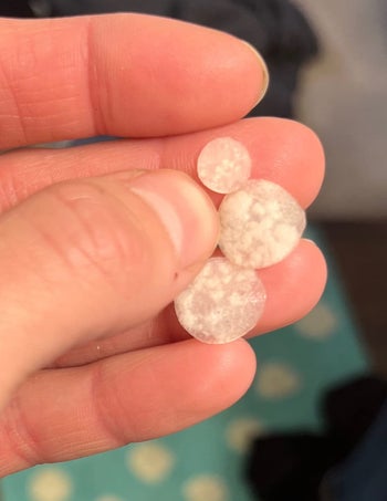 Reviewer holding their pimple patches showing all the gunk they've pulled out of their skin