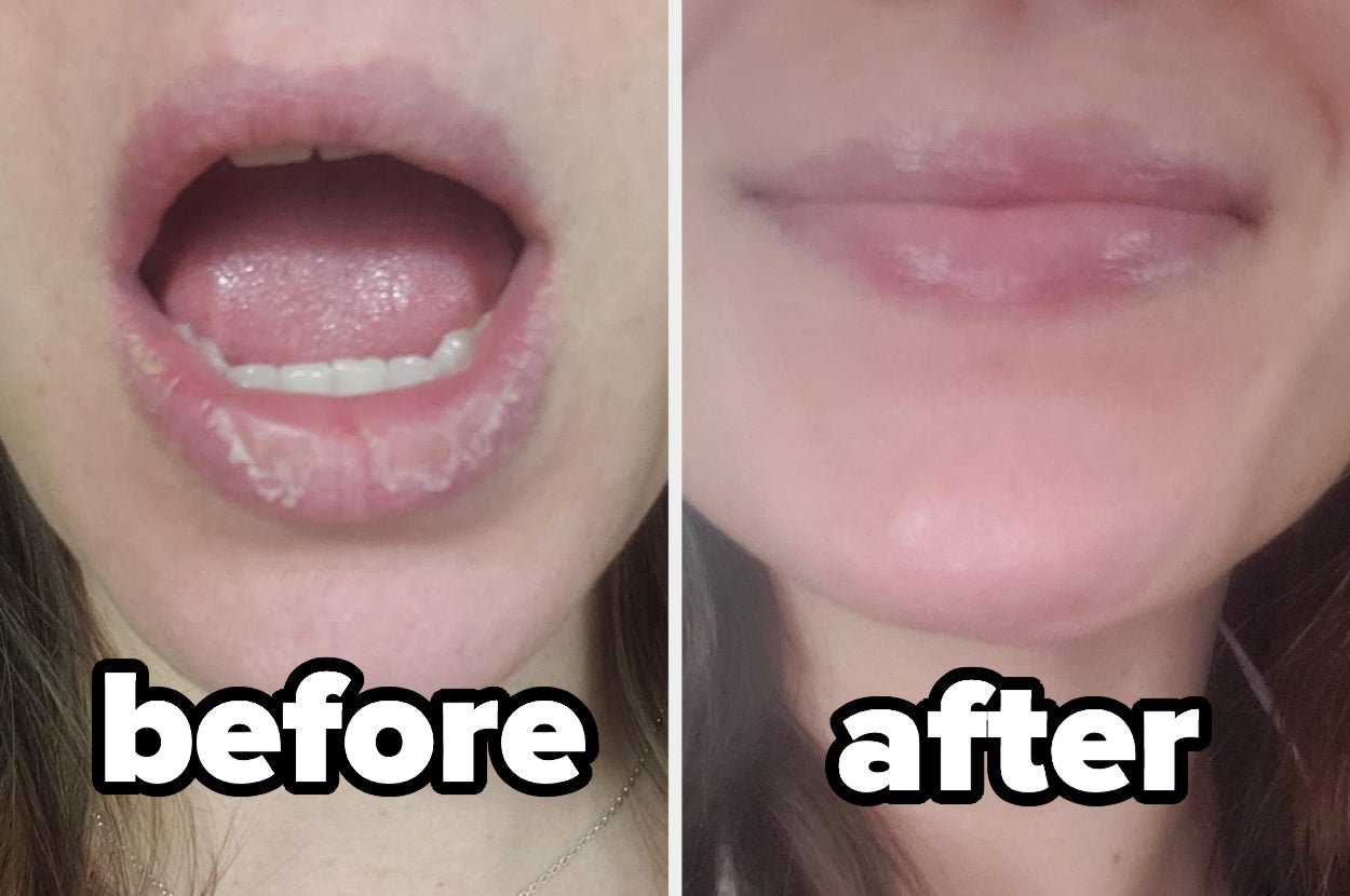 a reviewer's before and after showing them with cracked, peeling lips and then supple, hydrated lips