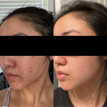 reviewers skin before and three weeks after using essence; dark spots faded after