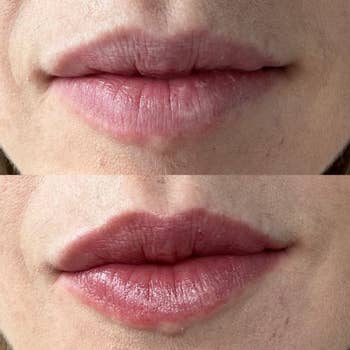 Close-up examination  of lips earlier  and aft  applying a articulator  product, showing enhanced fullness and smoothness