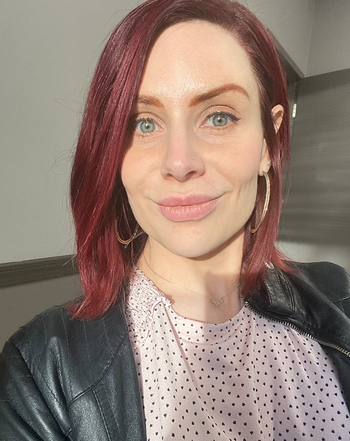 Reviewer with clear skin 