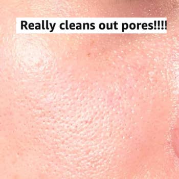 Close-up kulit dengan pori-pori dan teks yang terlihat: