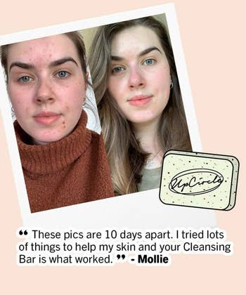A brand photo showing a user before/after use with reduced acne and redness and text 