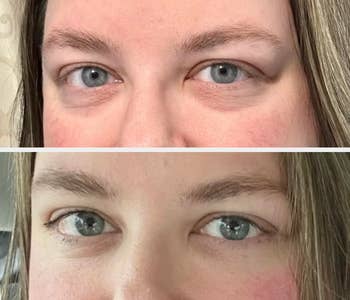 Close-up comparison of eyes before and after using a skincare product, focusing on skin texture and appearance