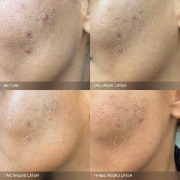 progression photos amusement   tegument  betterment  implicit    3  weeks