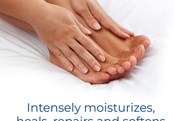 Model's feet after using Dr. Scholl's foot mask