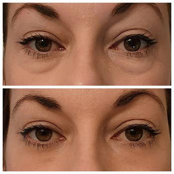 reviewer's eyes before and after using skin tightener with noticeable results