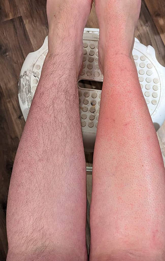 reviewers legs one hairy before being waxed, the other hairless after being waxed