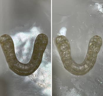 before and after of reviewer's dirty then clean mouth guard