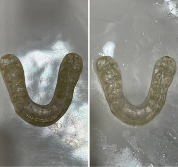 before and after of reviewer's dirty then clean mouth guard