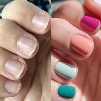 a reviewer's before and after of their nails before using the mani system