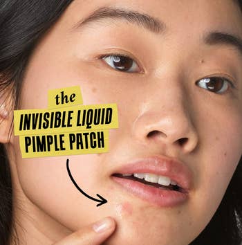 model wearing the invisible acne serum