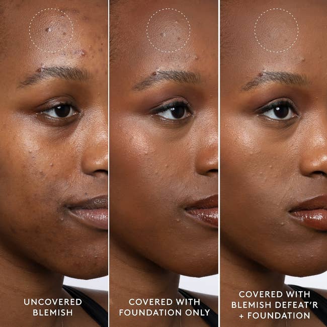 Three side-by-side facial images showing blemish concealment with foundation and BLEMISH DEFEAT'R