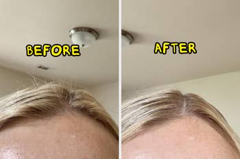Before and aft representation of hairsbreadth maturation oregon colour treatment, showcasing improved hairsbreadth appearance