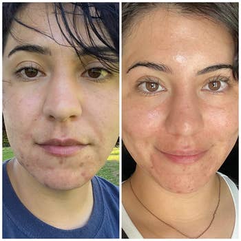 before/after of reviewer's skin looking glowy after using the bar