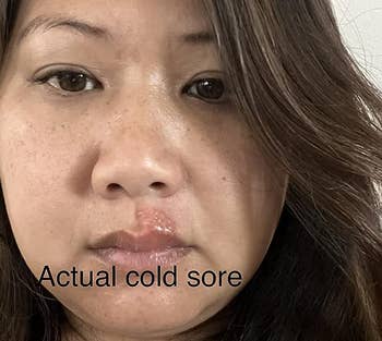 reviewer with a cold sore on their top lip