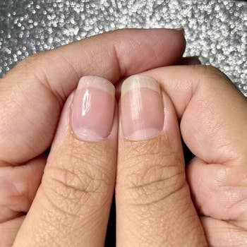 Close-up of two thumbs, one with nail concealer and one without