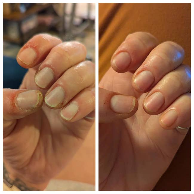 Close-up examination  of hands showing improvements successful  nail health, apt  for a quality   oregon  skincare article
