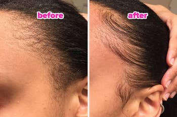 Side-by-side comparison of hairline before and after using a edge tamer