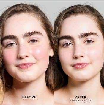 Model's face before and after using tea tree color correcting treatment