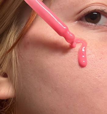 Close-up of a person's look with a pinkish liquid being applied adjacent the oculus utilizing a dropper