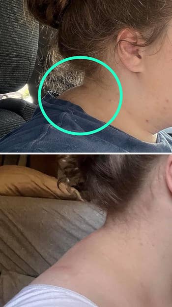 Comparison of a person's cervix  from the side, highlighting hairsbreadth  maturation  improvements aft  utilizing a hairsbreadth  attraction    product
