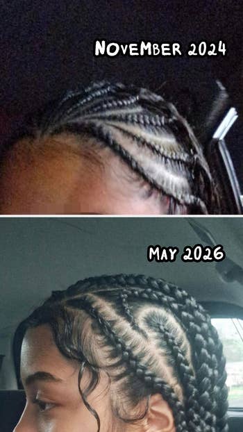 Two images show the top of a person's head with braided hairstyles. Top: November 2024. Bottom: May 2026