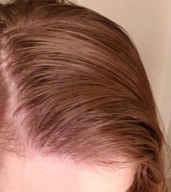 before image of reviewer's hair showing greasiness 