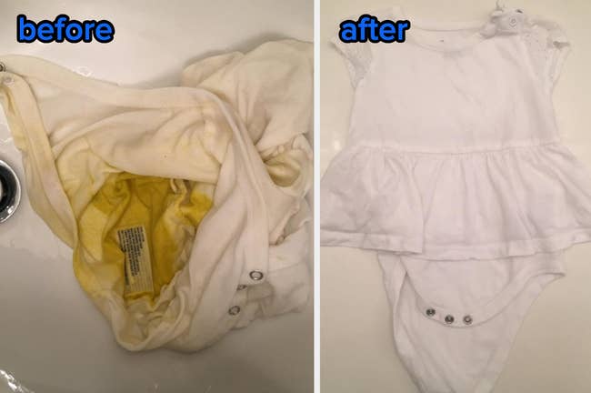 Reviewer's baby's clothes with large yellow poop stain covering the fabric, labeled before, and the baby clothes now pristine bright white and looking brand new after using OxiClean, now labeled after