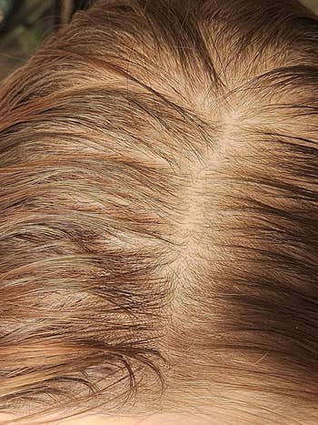 Close-up of a person's scalp with healthy, parted hair showing the roots. The article is related to hair care products