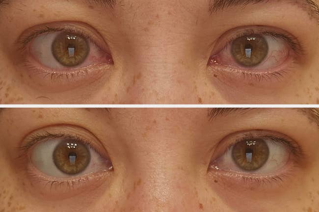 Close-up of eyes in two images, one above the other, showing a before-and-after comparison of eyelash or eye makeup application