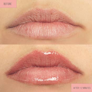 before and after photos of a model's lips, showing them looking more plump and hydrated 1-2 minutes after application of the lip plump