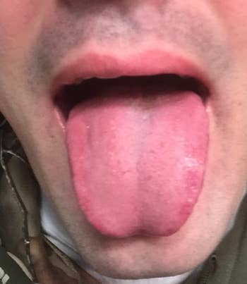 after image of reviewer's now clean and pink tongue
